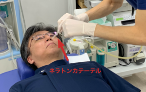 ネラトンカテーテル挿入