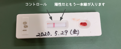 抗体検査結果